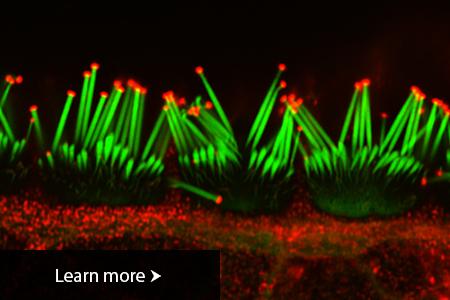 P15 mouse inner hair cells of the organ of Corti used for immunofluorescent detection of actin filaments (shown in green, Phaloidin-488) and Eps8 (shown in red) by confocal microscopy superresolution imaging.