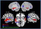 Scan of brain activity